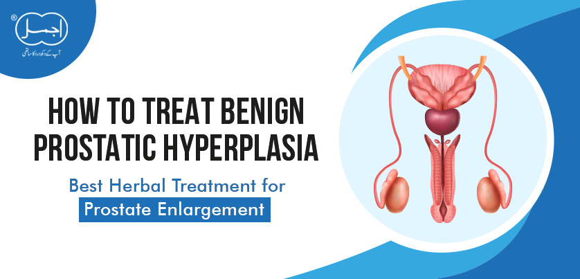 How to Treat Benign Prostatic Hyperplasia | Best Herbal Treatment for Prostate Enlargement